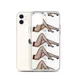 iPhone Case Stockings