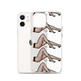 iPhone Case Stockings