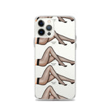 iPhone Case Stockings