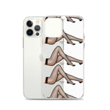 iPhone Case Stockings